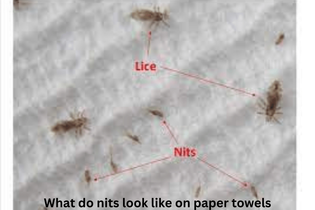 What Do Nits Look Like on Paper Towels? (Picture & videos)